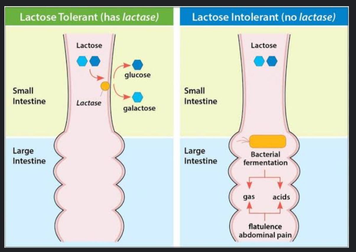 LAKTOZ INTOLERANSI